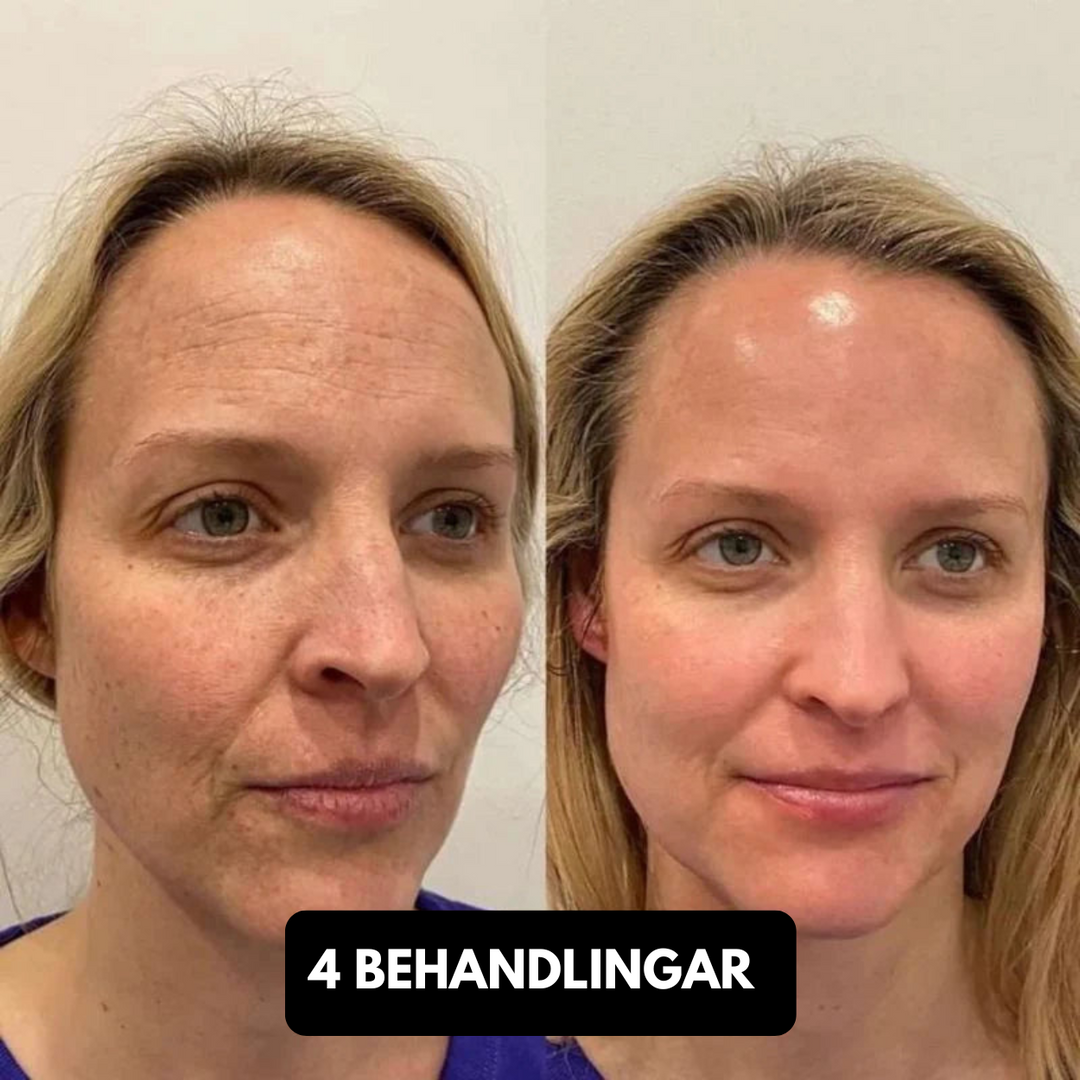 Pore Detox Pro™ | Ta bort pormaskar med precision