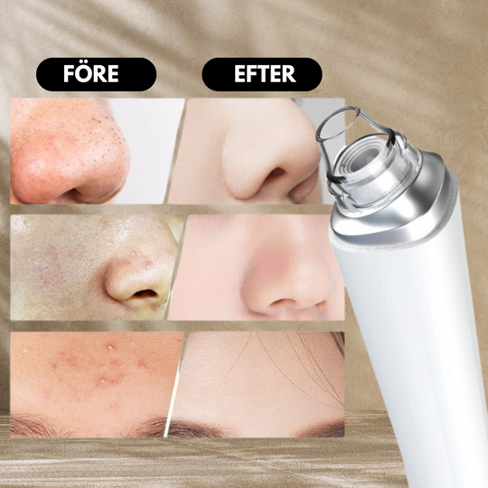 Pore Detox Pro™ | Ta bort pormaskar med precision